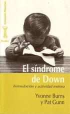 El Síndrome de Down - Yvonne Burns - Herder